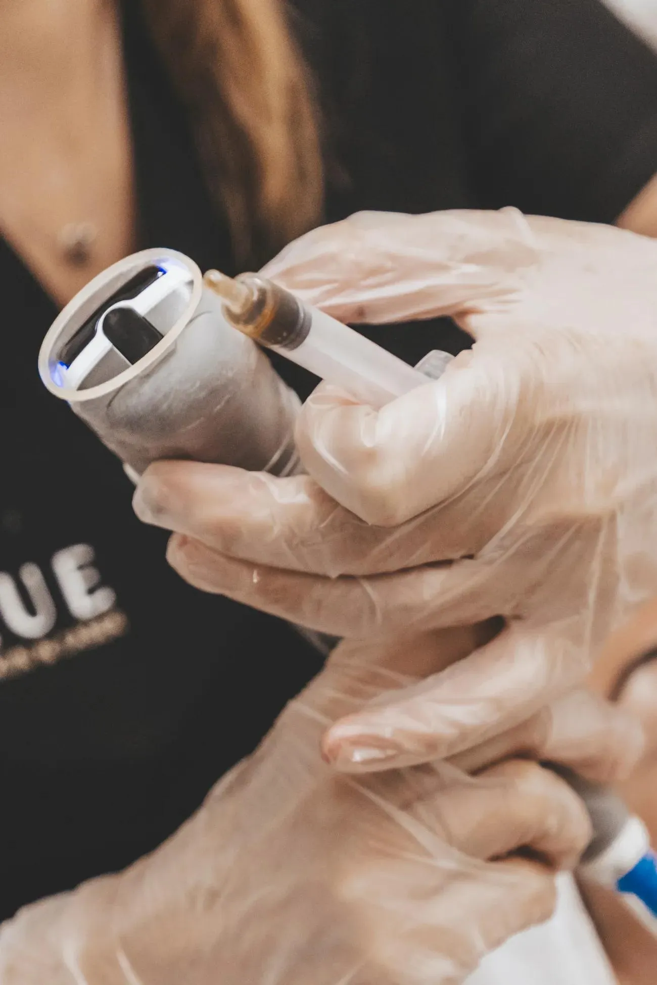 A sterile cartridge being fitted into the barrel of a microneedling pen